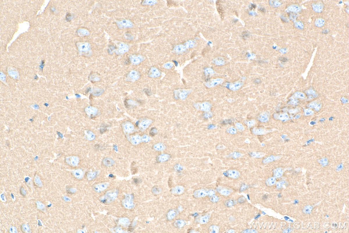 Immunohistochemistry (IHC) staining of mouse brain tissue using SNAP25 Recombinant antibody (83259-1-RR)