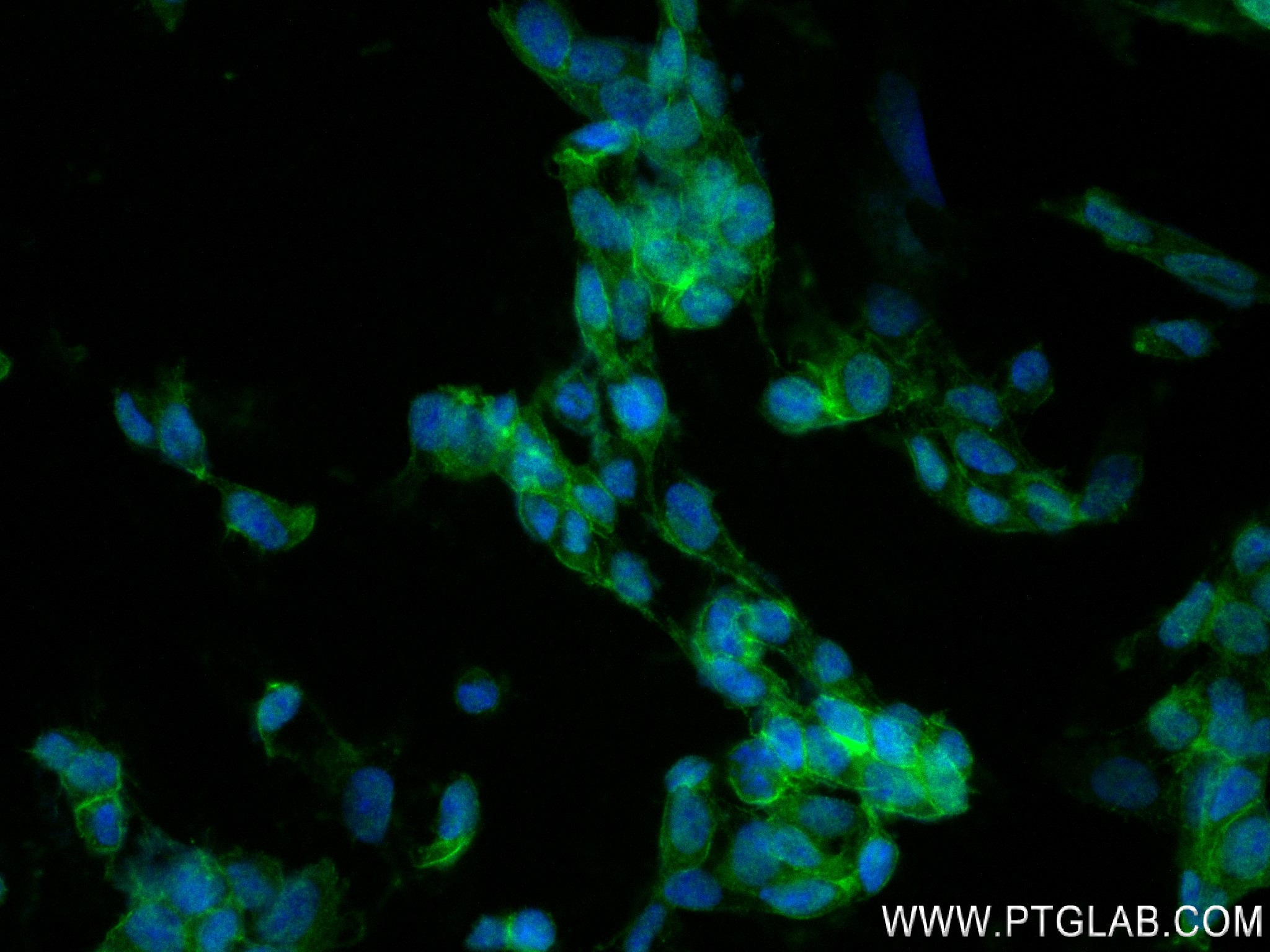 Immunofluorescence (IF) / fluorescent staining of SH-SY5Y cells using SNAP25 Recombinant antibody (83259-5-RR)