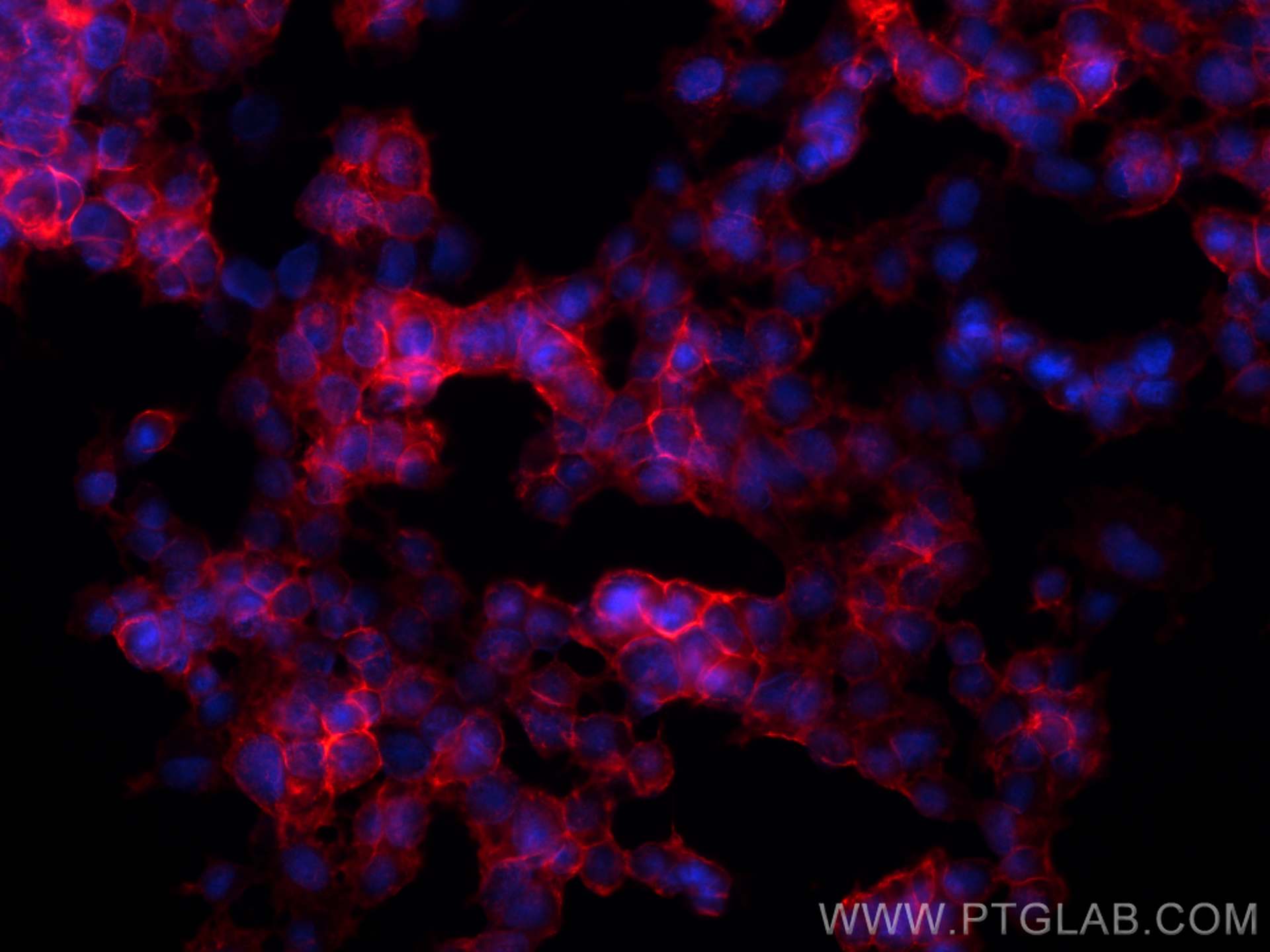 Immunofluorescence (IF) / fluorescent staining of PC-12 cells using CoraLite®594-conjugated SNAP25 Monoclonal antibody (CL594-60159)