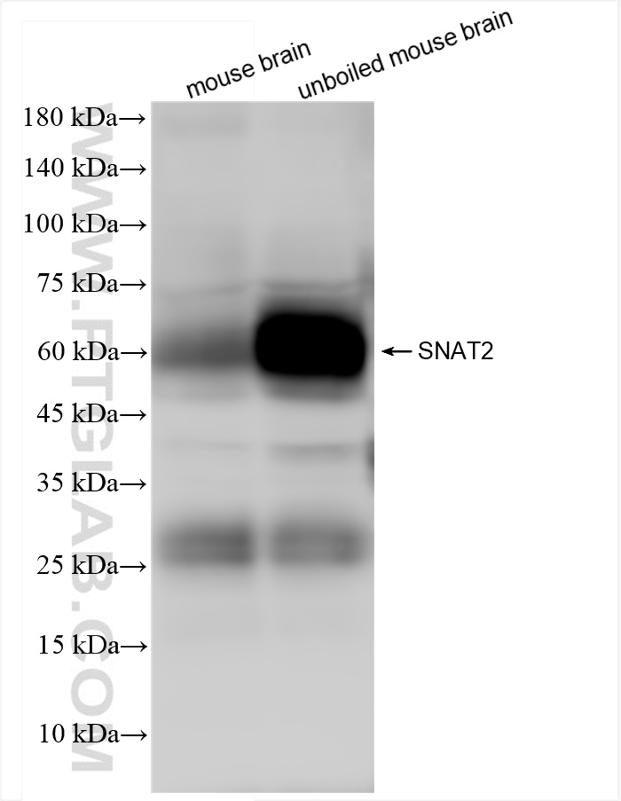 Western Blot (WB) analysis of various lysates using SNAT2 Recombinant antibody (83968-5-RR)