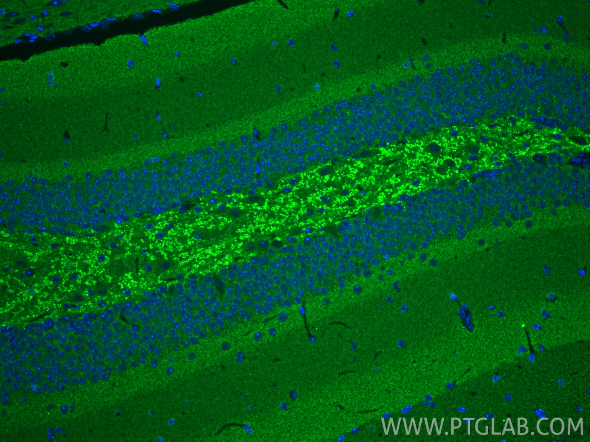 Immunofluorescence (IF) / fluorescent staining of mouse brain tissue using Alpha Synuclein Polyclonal antibody (10842-1-AP)