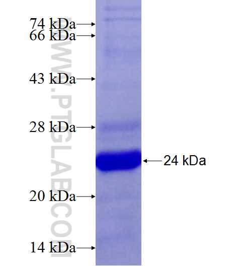 SNED1 fusion protein Ag25011 SDS-PAGE