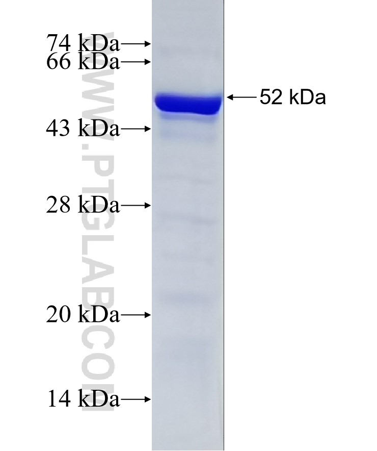 SNIP1 fusion protein Ag33543 SDS-PAGE