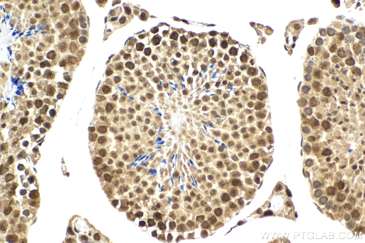 Immunohistochemistry (IHC) staining of mouse testis tissue using SNRNP200 Polyclonal antibody (23875-1-AP)