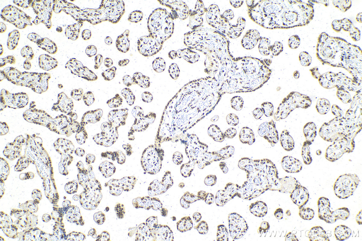 Immunohistochemistry (IHC) staining of human placenta tissue using SNRNP200 Polyclonal antibody (23875-1-AP)