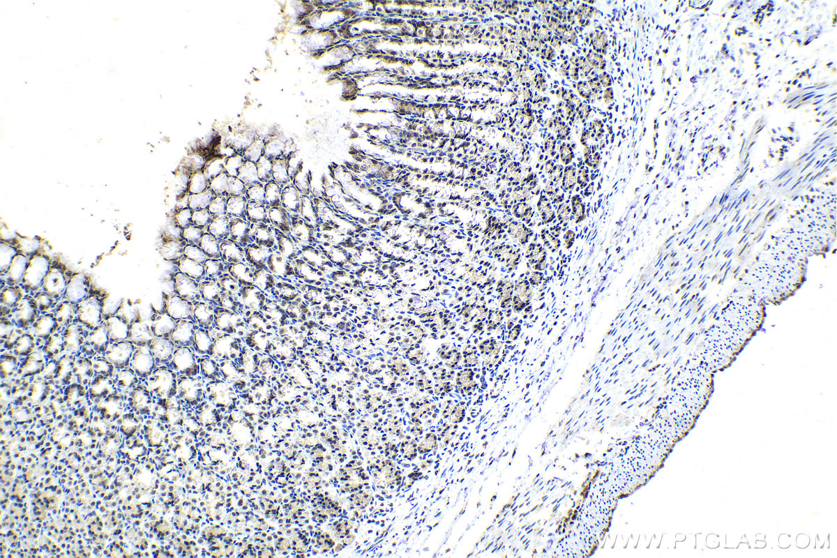 Immunohistochemistry (IHC) staining of rat stomach tissue using SNRNP200 Polyclonal antibody (23875-1-AP)