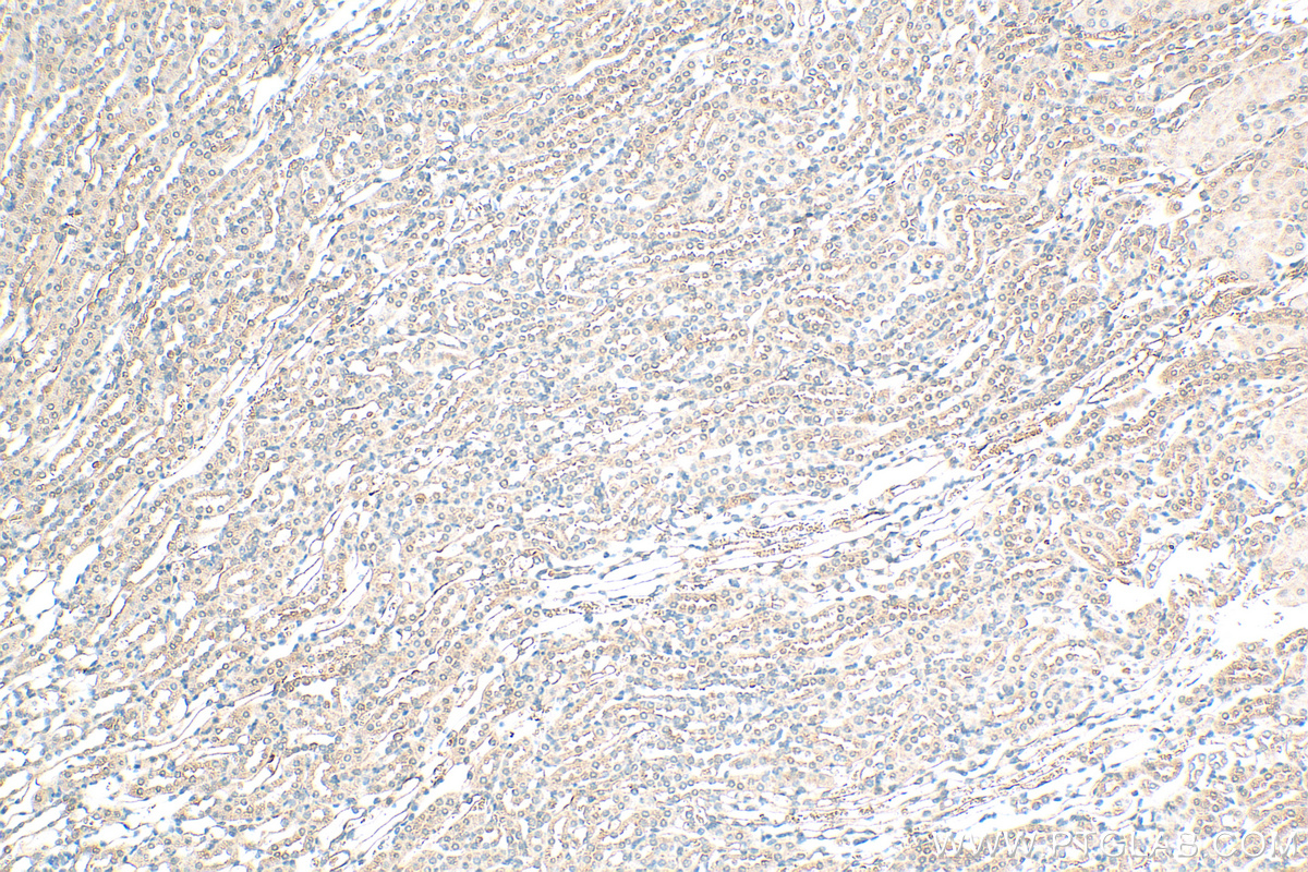 Immunohistochemistry (IHC) staining of mouse kidney tissue using SNX15 Polyclonal antibody (16049-1-AP)