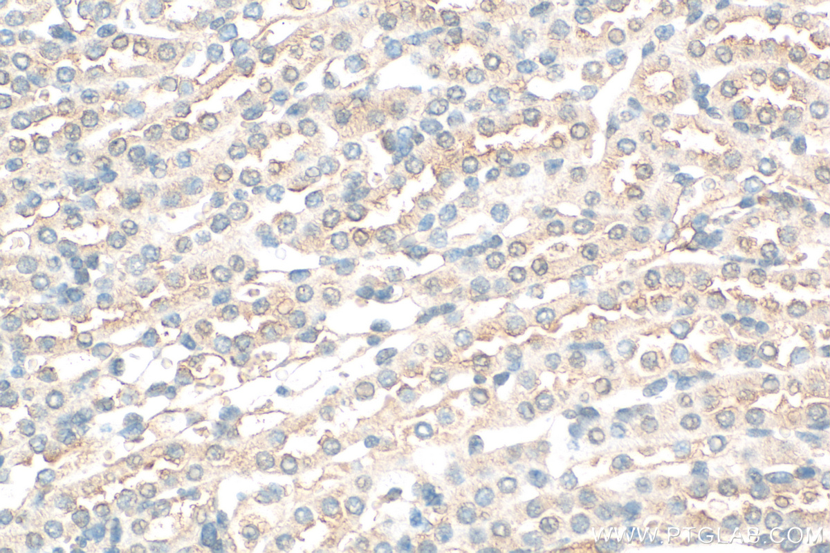 Immunohistochemistry (IHC) staining of mouse kidney tissue using SNX15 Polyclonal antibody (16049-1-AP)