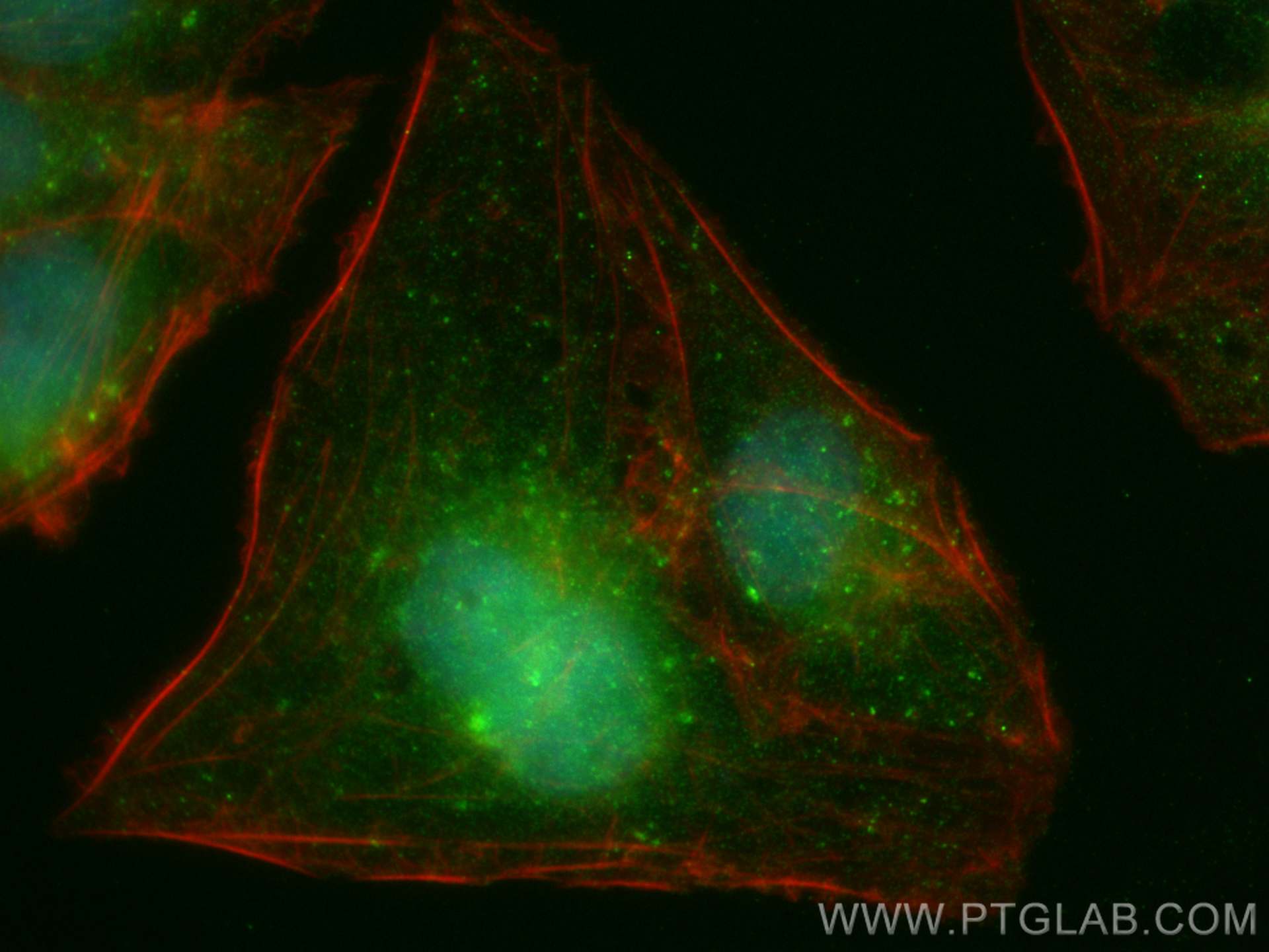 Immunofluorescence (IF) / fluorescent staining of U2OS cells using SNX15 Monoclonal antibody (68239-1-Ig)