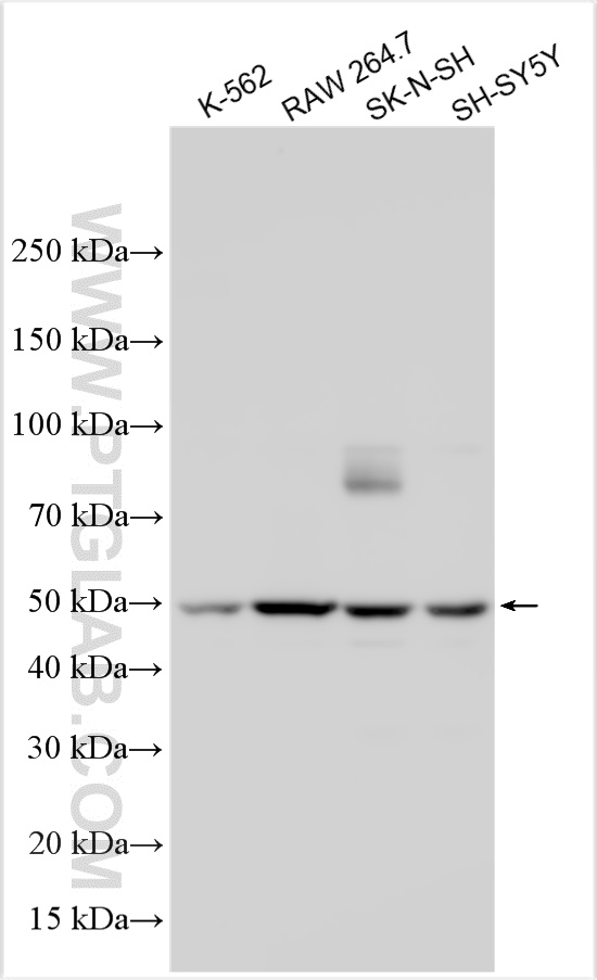 Western Blot (WB) analysis of various lysates using SNX17 Polyclonal antibody (10275-1-AP)