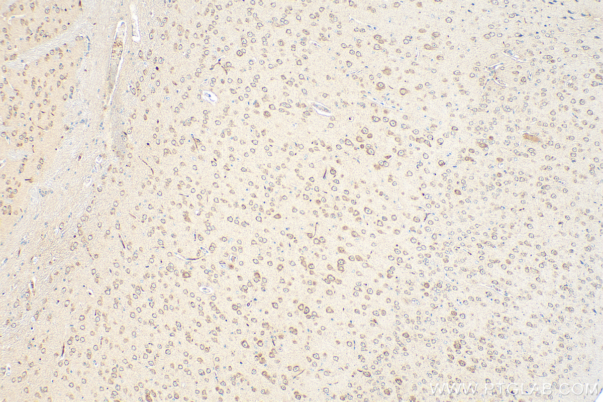 Immunohistochemistry (IHC) staining of mouse brain tissue using SNX17 Monoclonal antibody (68256-1-Ig)