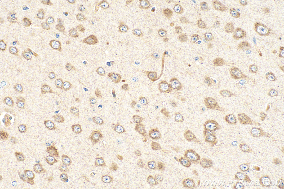 Immunohistochemistry (IHC) staining of mouse brain tissue using SNX17 Monoclonal antibody (68256-1-Ig)