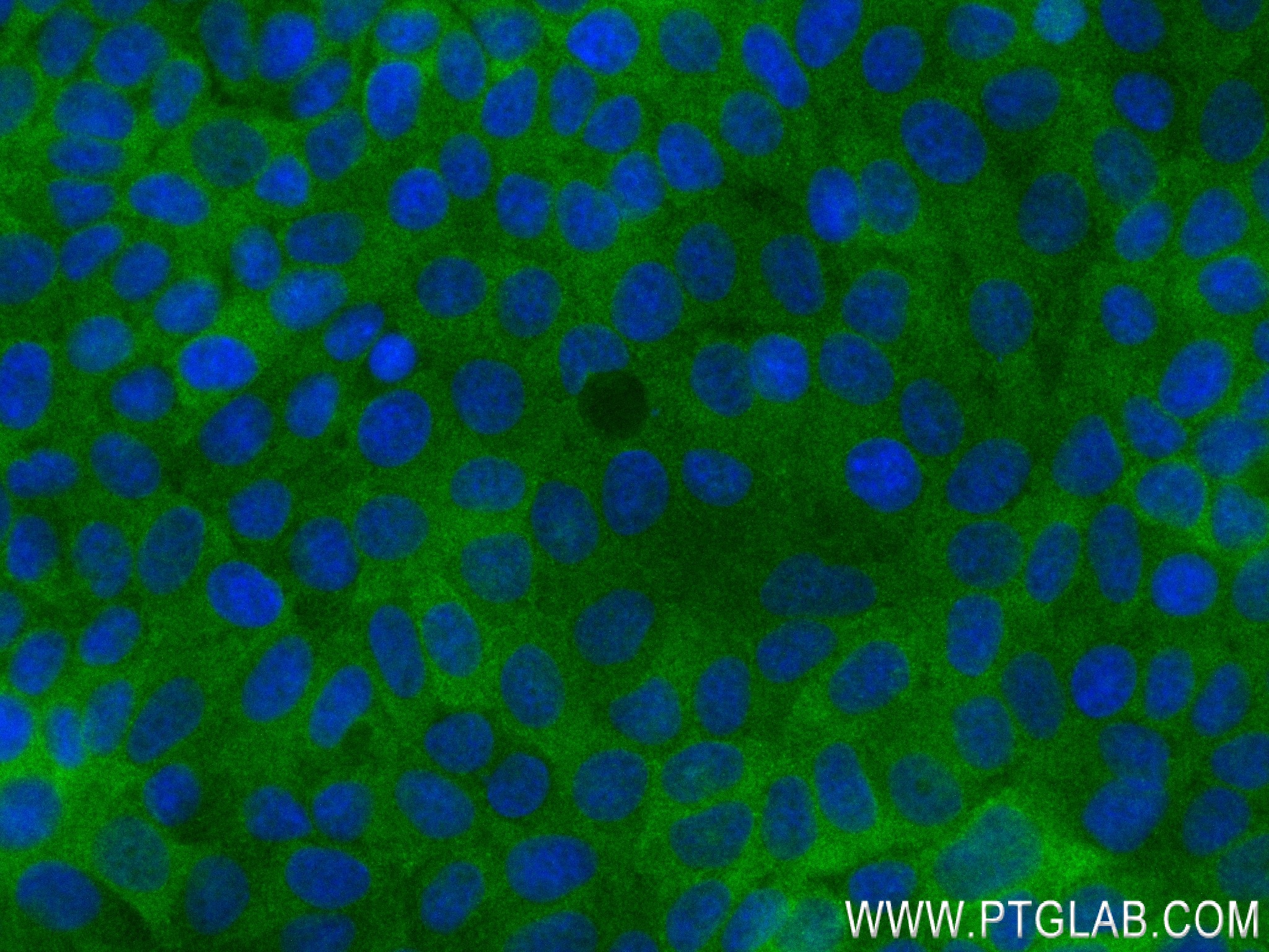 Immunofluorescence (IF) / fluorescent staining of MCF-7 cells using SNX18 Recombinant antibody (84215-1-RR)