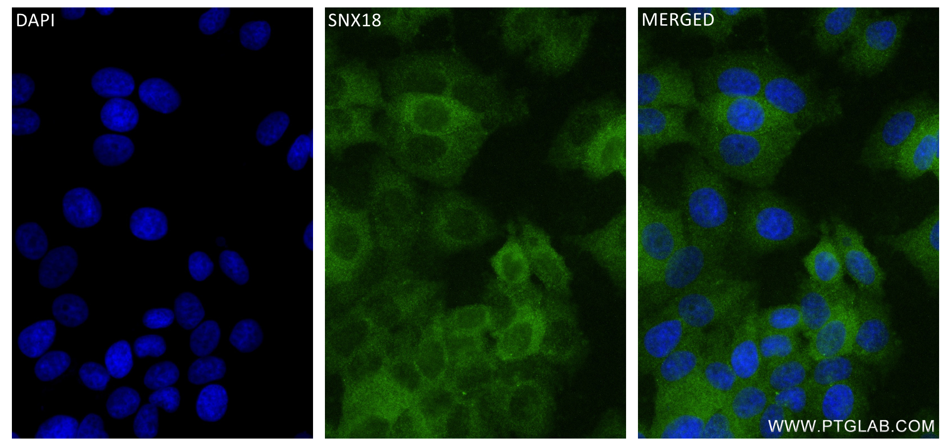 Immunofluorescence (IF) / fluorescent staining of MCF-7 cells using SNX18 Recombinant antibody (84215-4-RR)