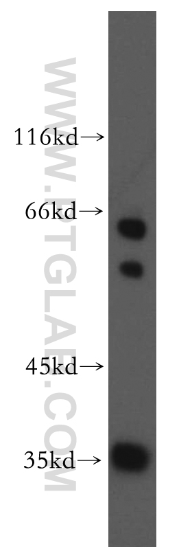 Western Blot (WB) analysis of COLO 320 cells using SNX20 Polyclonal antibody (13180-1-AP)