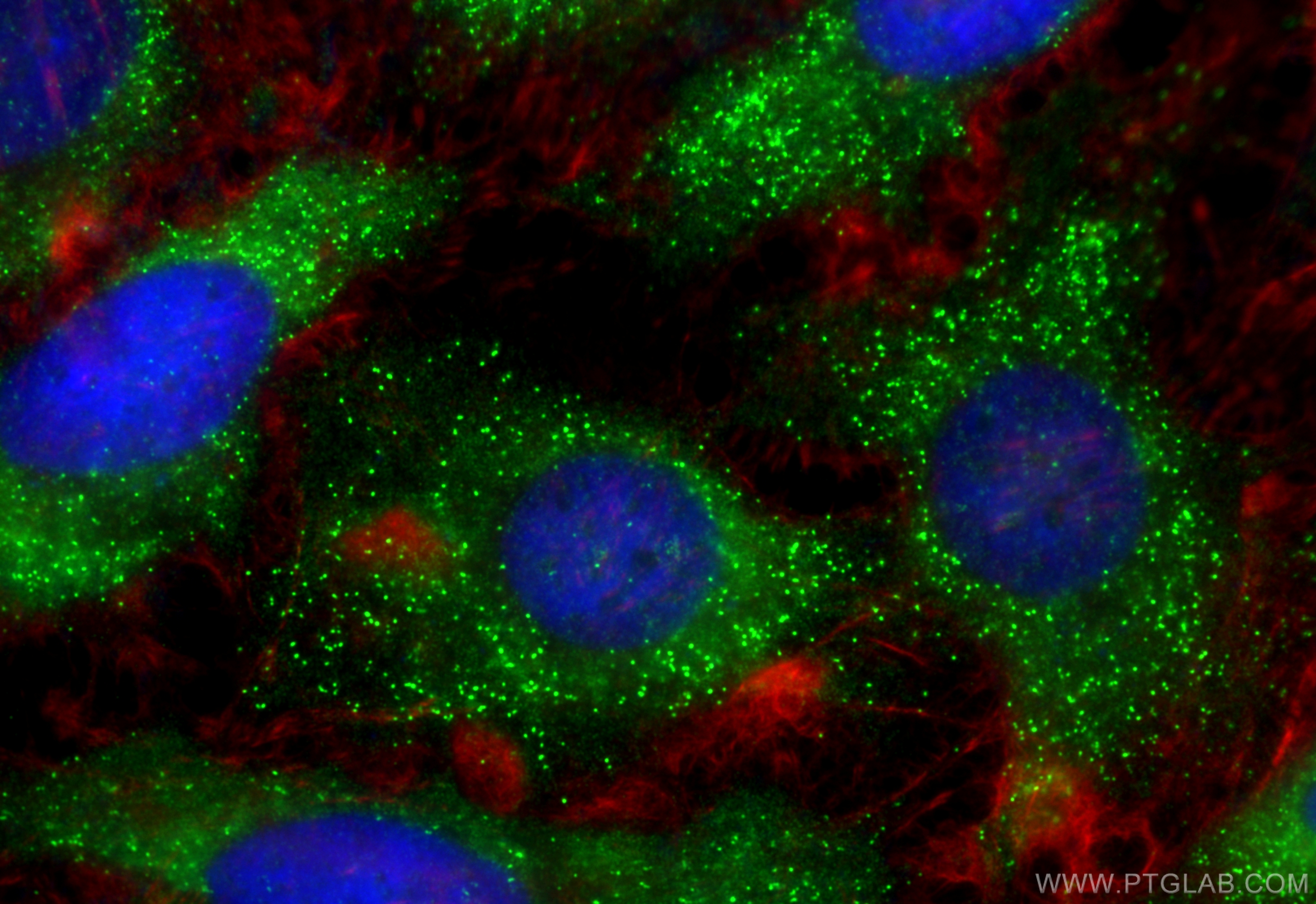 Immunofluorescence (IF) / fluorescent staining of HeLa cells using SNX25 Polyclonal antibody (13294-1-AP)