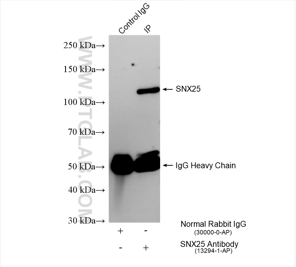 Immunoprecipitation (IP) experiment of Raji cells using SNX25 Polyclonal antibody (13294-1-AP)