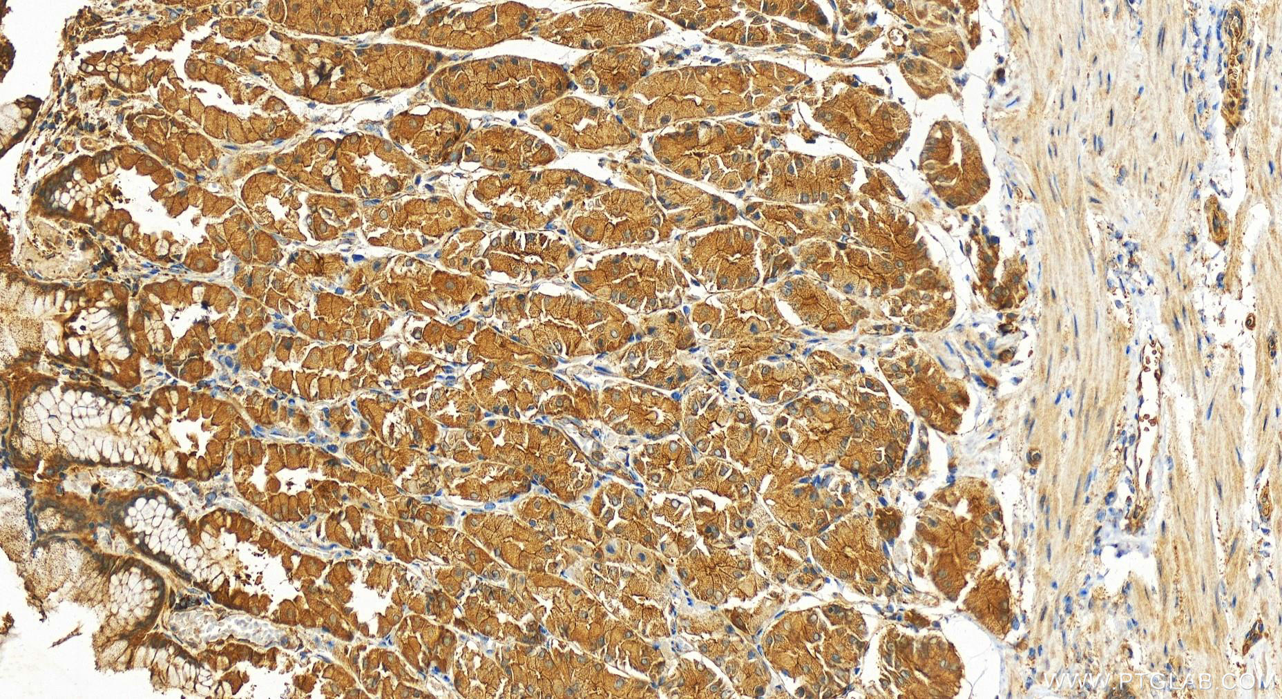 Immunohistochemistry (IHC) staining of human stomach tissue using SNX4 Polyclonal antibody (11506-1-AP)