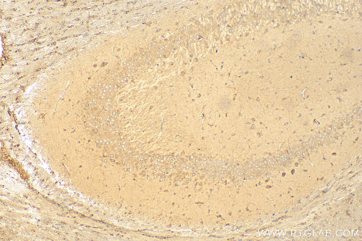 Immunohistochemistry (IHC) staining of mouse brain tissue using SNX5 Polyclonal antibody (17918-1-AP)