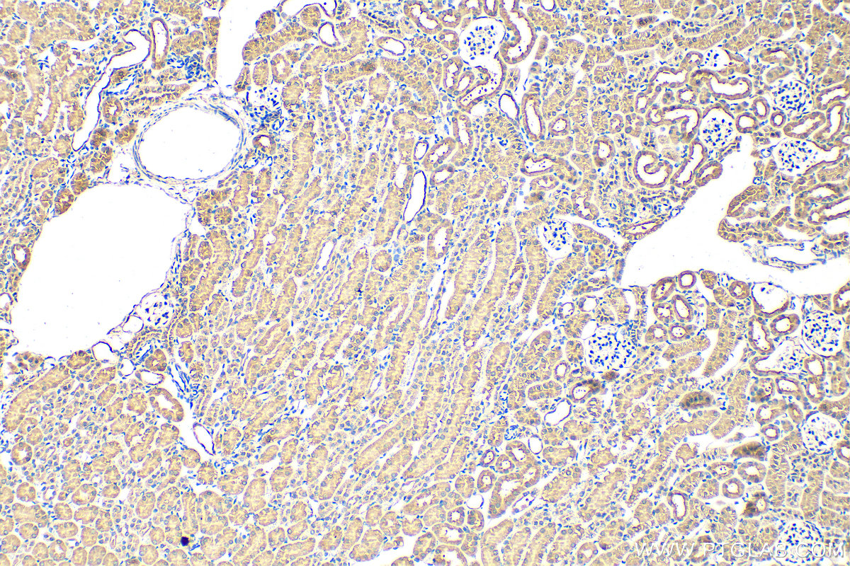 Immunohistochemistry (IHC) staining of mouse kidney tissue using SNX8 Polyclonal antibody (11494-1-AP)