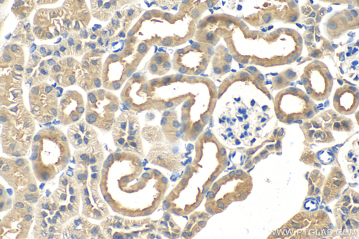 Immunohistochemistry (IHC) staining of mouse kidney tissue using SNX8 Polyclonal antibody (11494-1-AP)