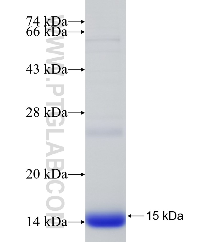 SOCS3 fusion protein Ag31548 SDS-PAGE