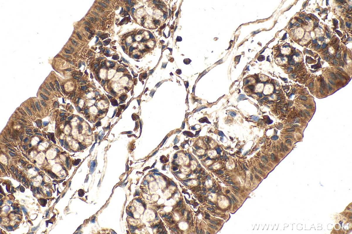 Immunohistochemistry (IHC) staining of mouse colon tissue using SOCS6 Polyclonal antibody (27343-1-AP)