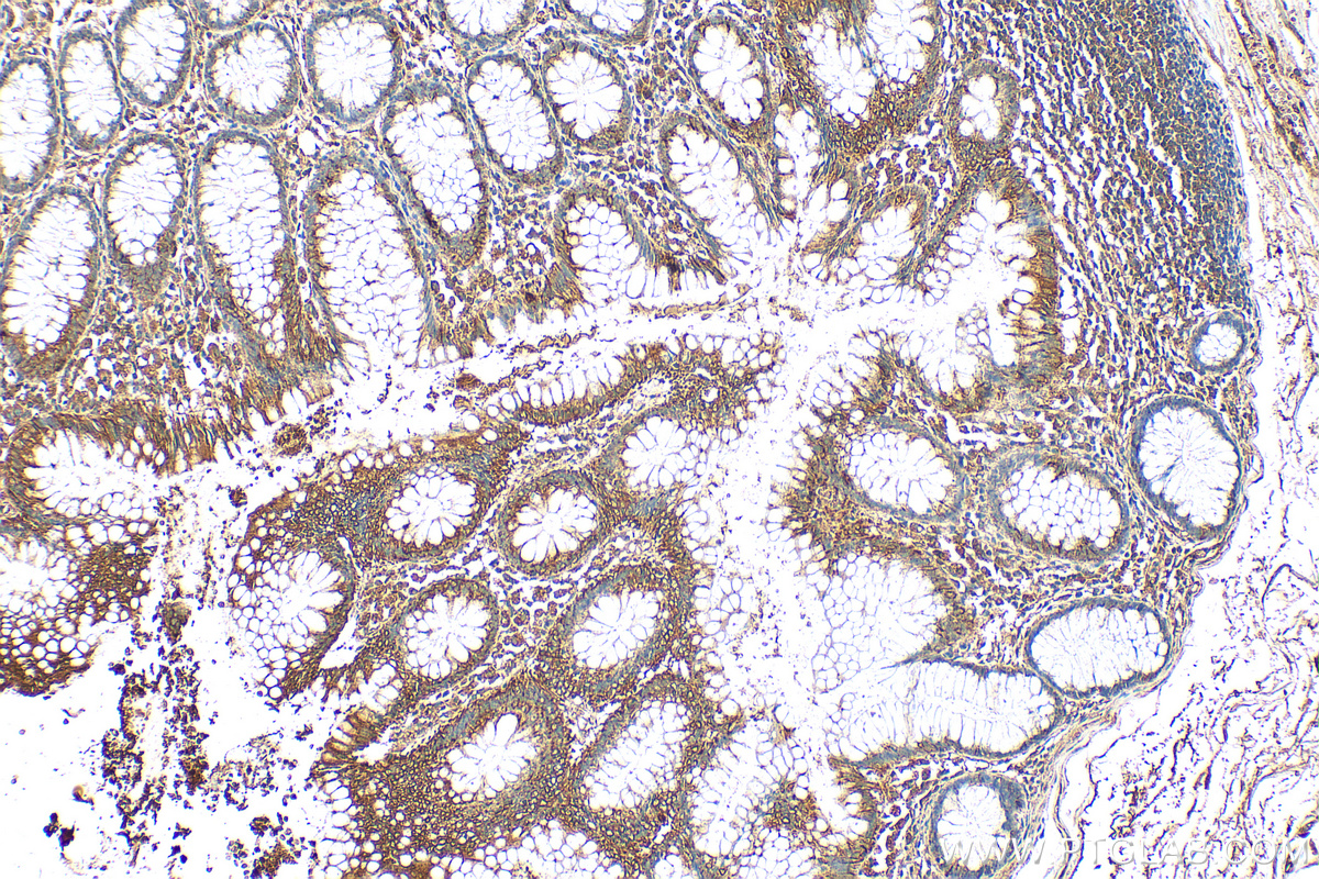 Immunohistochemistry (IHC) staining of human colon tissue using SOCS6 Polyclonal antibody (27343-1-AP)