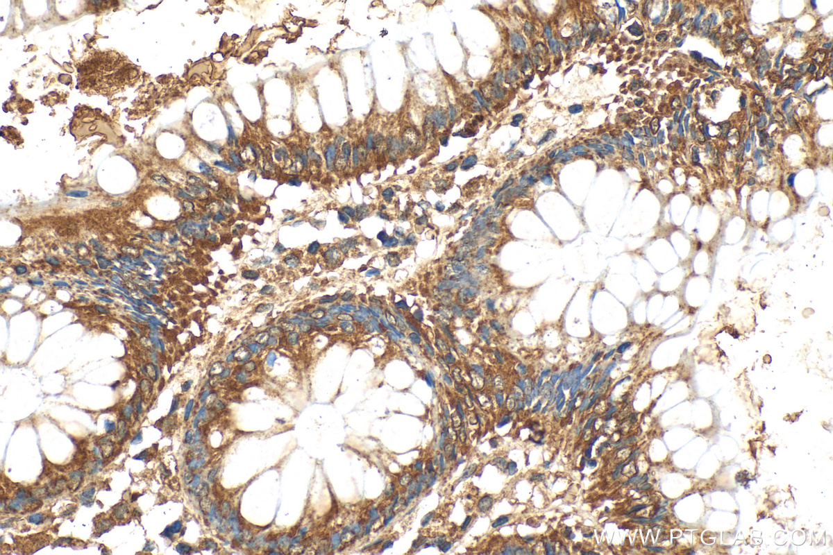 Immunohistochemistry (IHC) staining of human colon tissue using SOCS6 Polyclonal antibody (27343-1-AP)