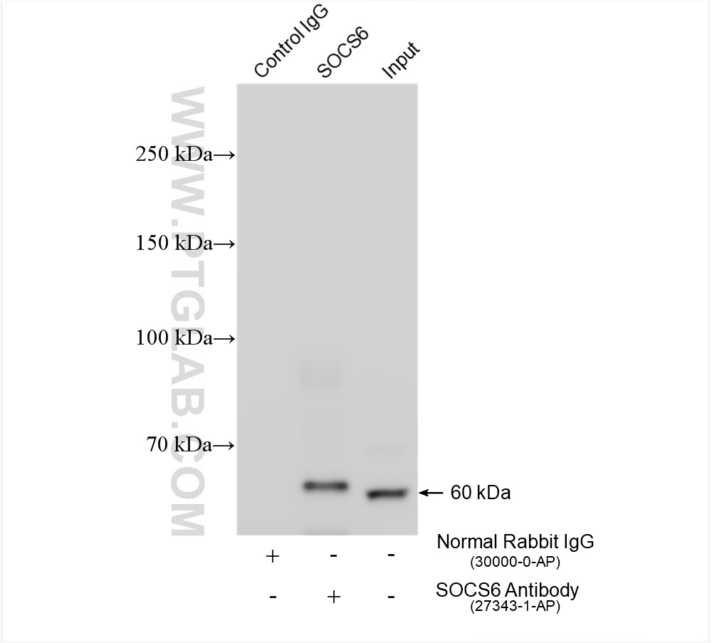 Immunoprecipitation (IP) experiment of human placenta tissue using SOCS6 Polyclonal antibody (27343-1-AP)