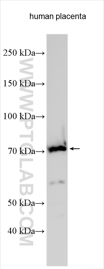 Western Blot (WB) analysis of various lysates using SOCS6 Polyclonal antibody (27343-1-AP)