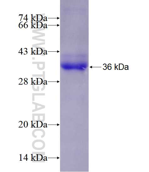 SOCS6 fusion protein Ag25594 SDS-PAGE