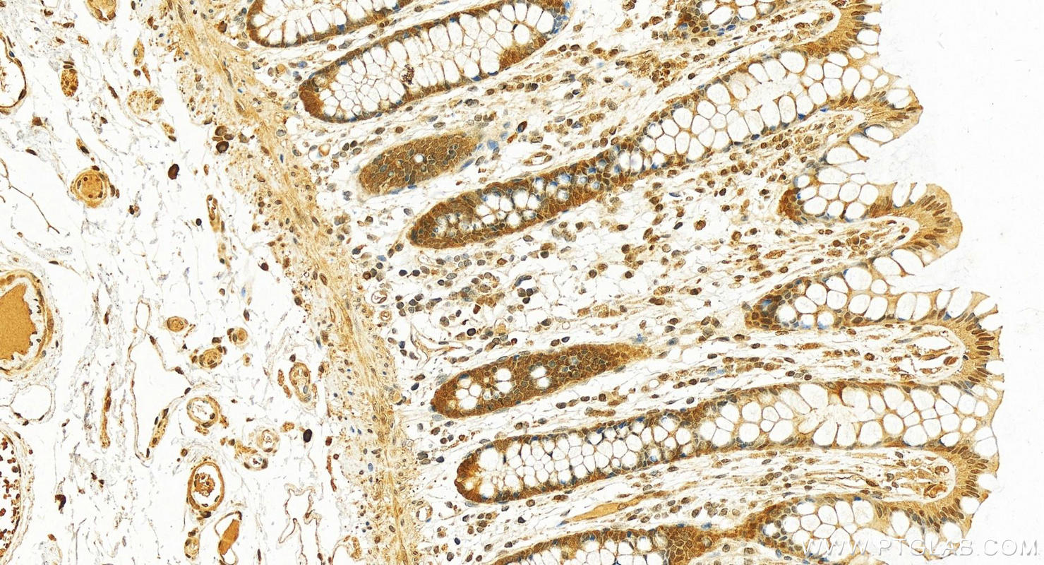 Immunohistochemistry (IHC) staining of human colon tissue using SOD1 Polyclonal antibody (10269-1-AP)