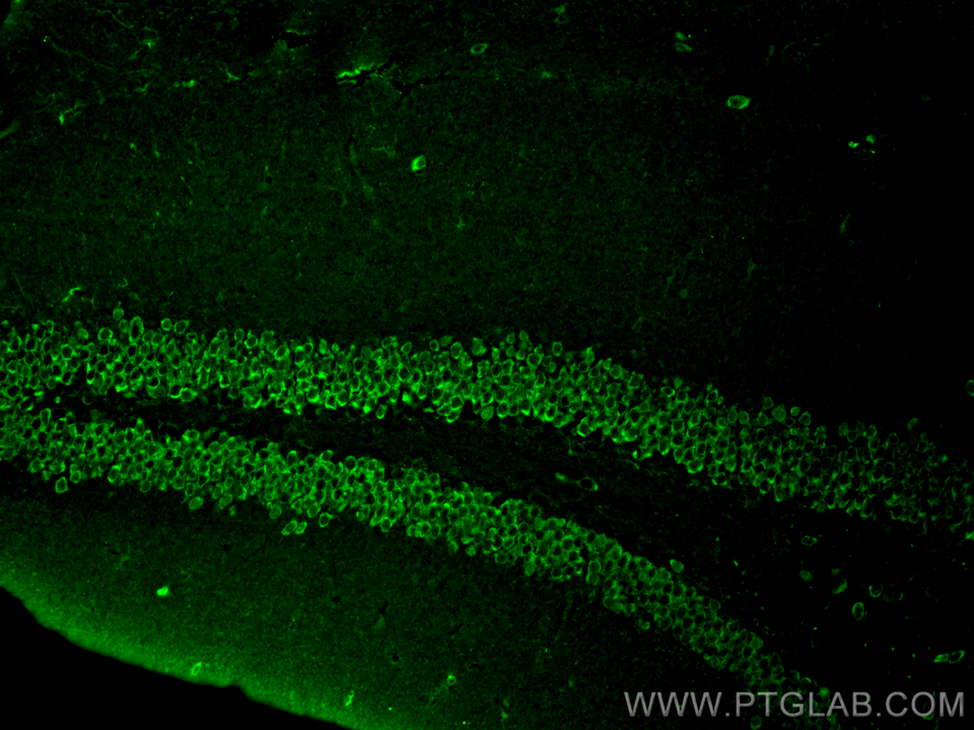 Immunofluorescence (IF) / fluorescent staining of mouse brain tissue using SOD1 Polyclonal antibody (10269-1-AP)