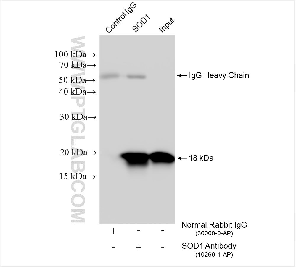 Immunoprecipitation (IP) experiment of HEK-293 cells using SOD1 Polyclonal antibody (10269-1-AP)
