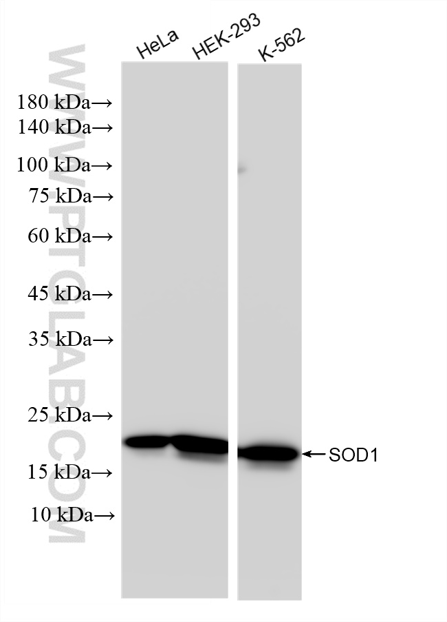 Western Blot (WB) analysis of various lysates using SOD1 Recombinant antibody (83857-6-RR)