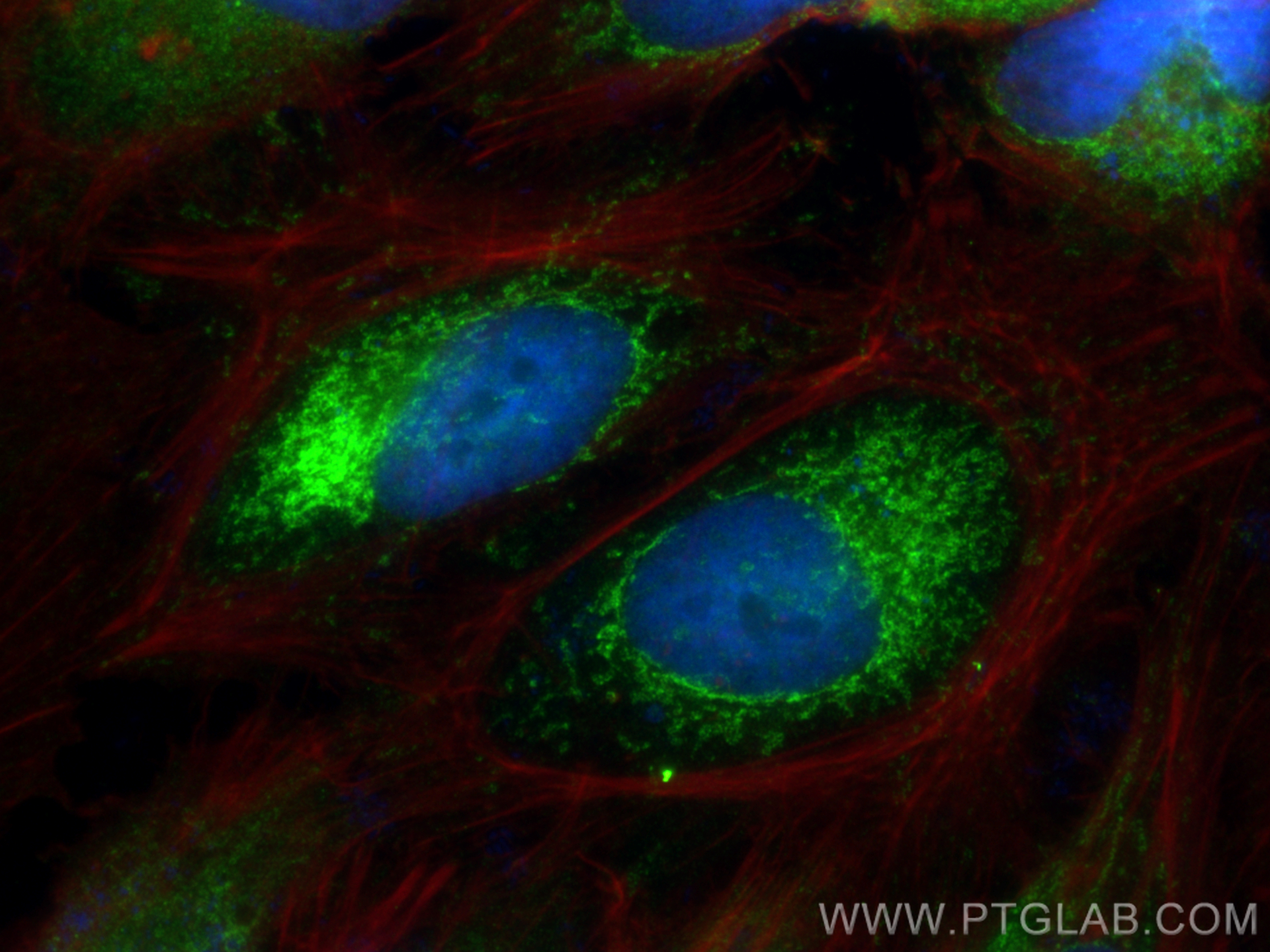 Immunofluorescence (IF) / fluorescent staining of HeLa cells using SOD2 Polyclonal antibody (24127-1-AP)