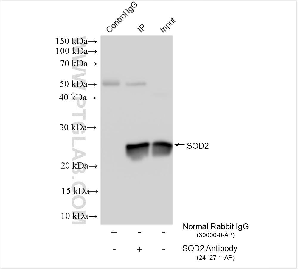 Immunoprecipitation (IP) experiment of mouse brain tissue using SOD2 Polyclonal antibody (24127-1-AP)