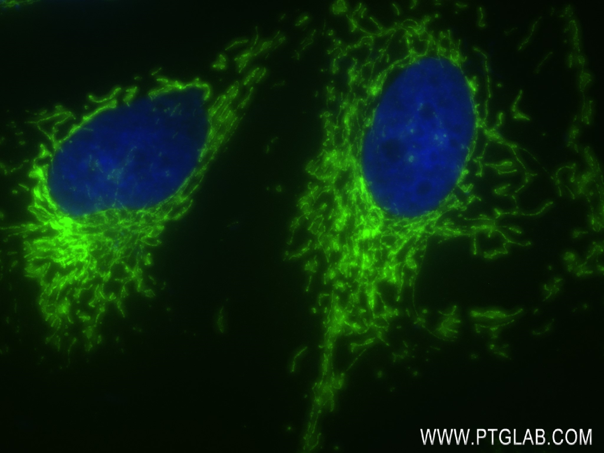 Immunofluorescence (IF) / fluorescent staining of HeLa cells using SOD2 Recombinant antibody (83519-2-RR)