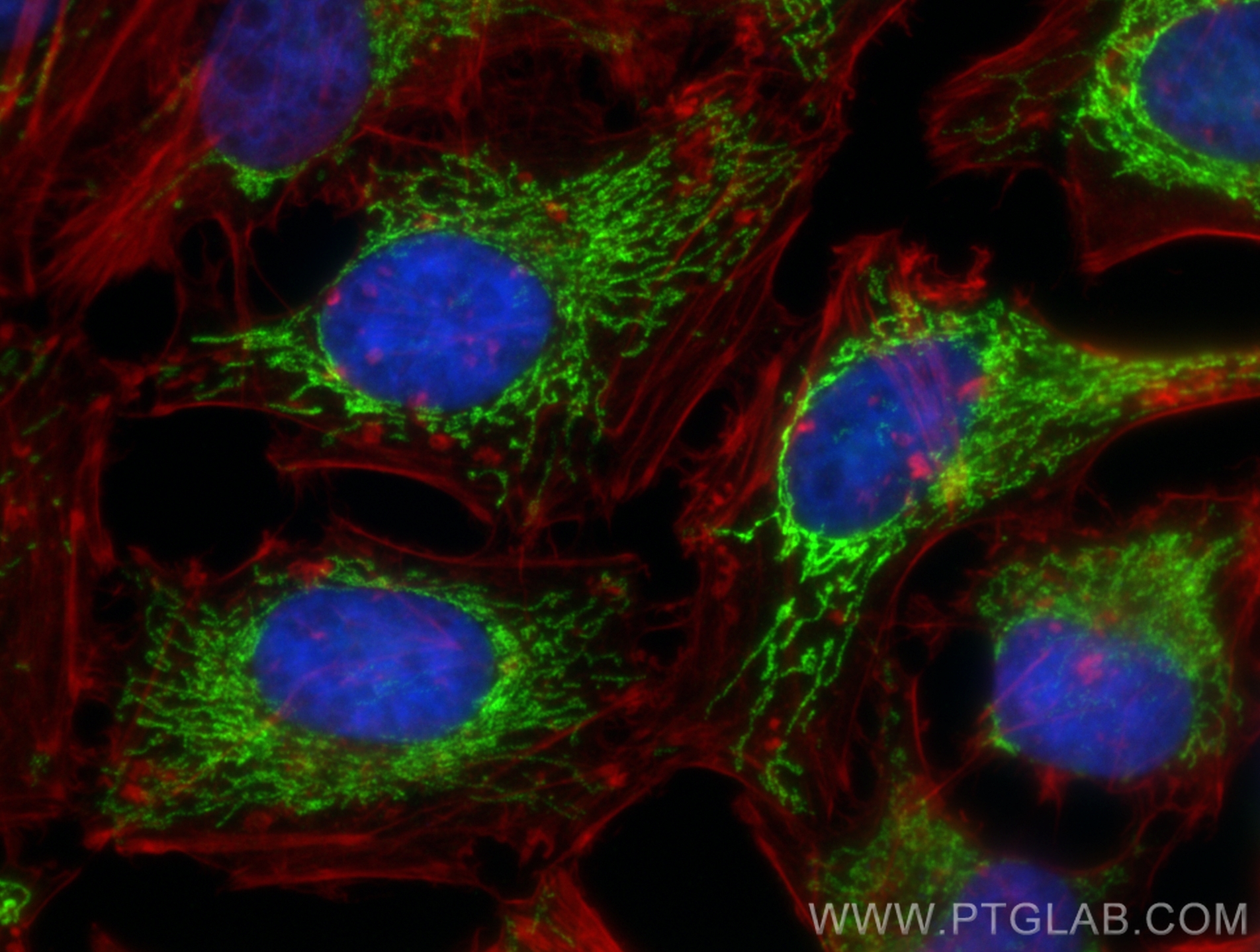 Immunofluorescence (IF) / fluorescent staining of HeLa cells using SOD2 Recombinant antibody (83519-2-RR)