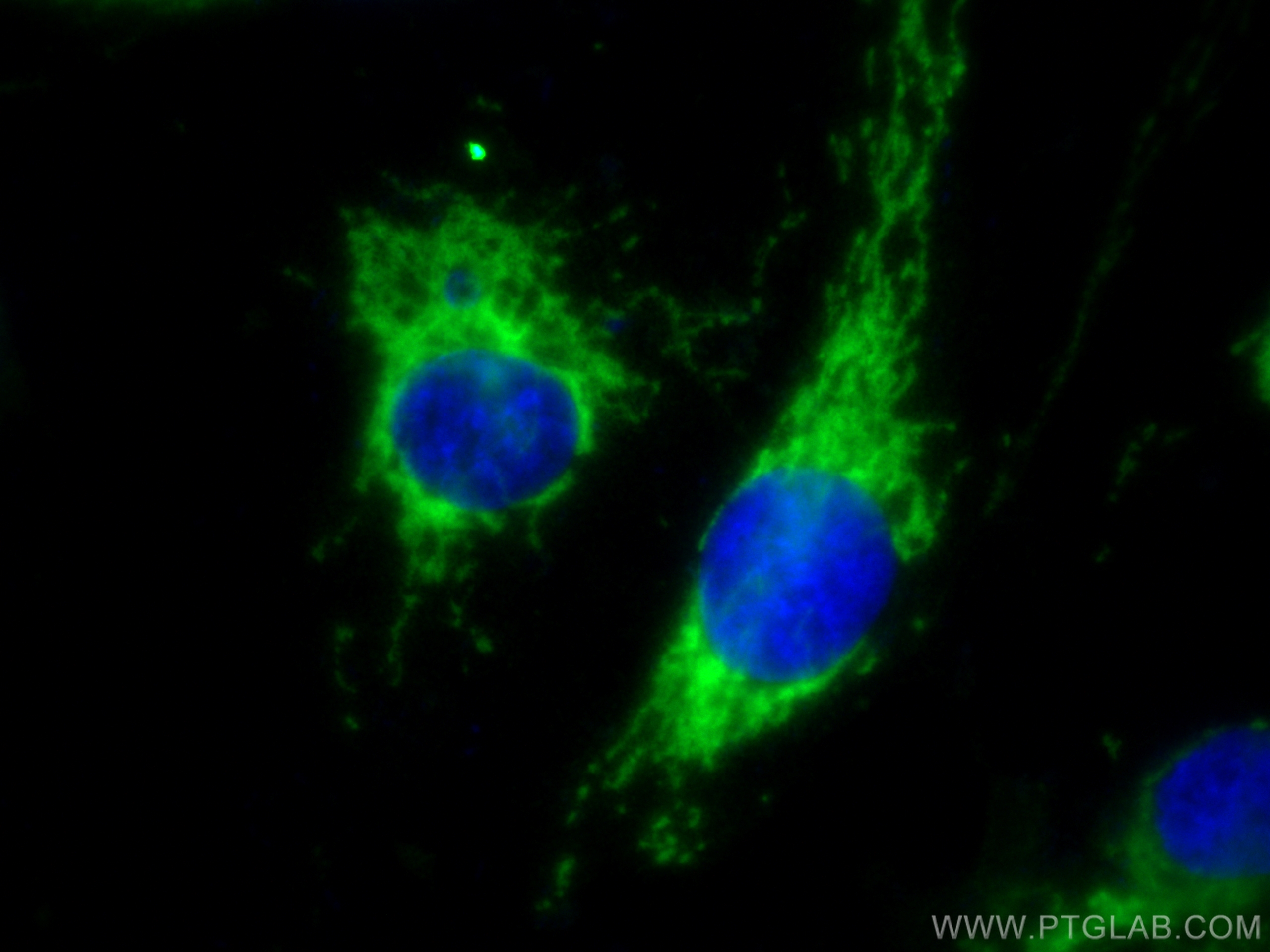 Immunofluorescence (IF) / fluorescent staining of HUVEC cells using SOD2 Recombinant antibody (83519-3-RR)