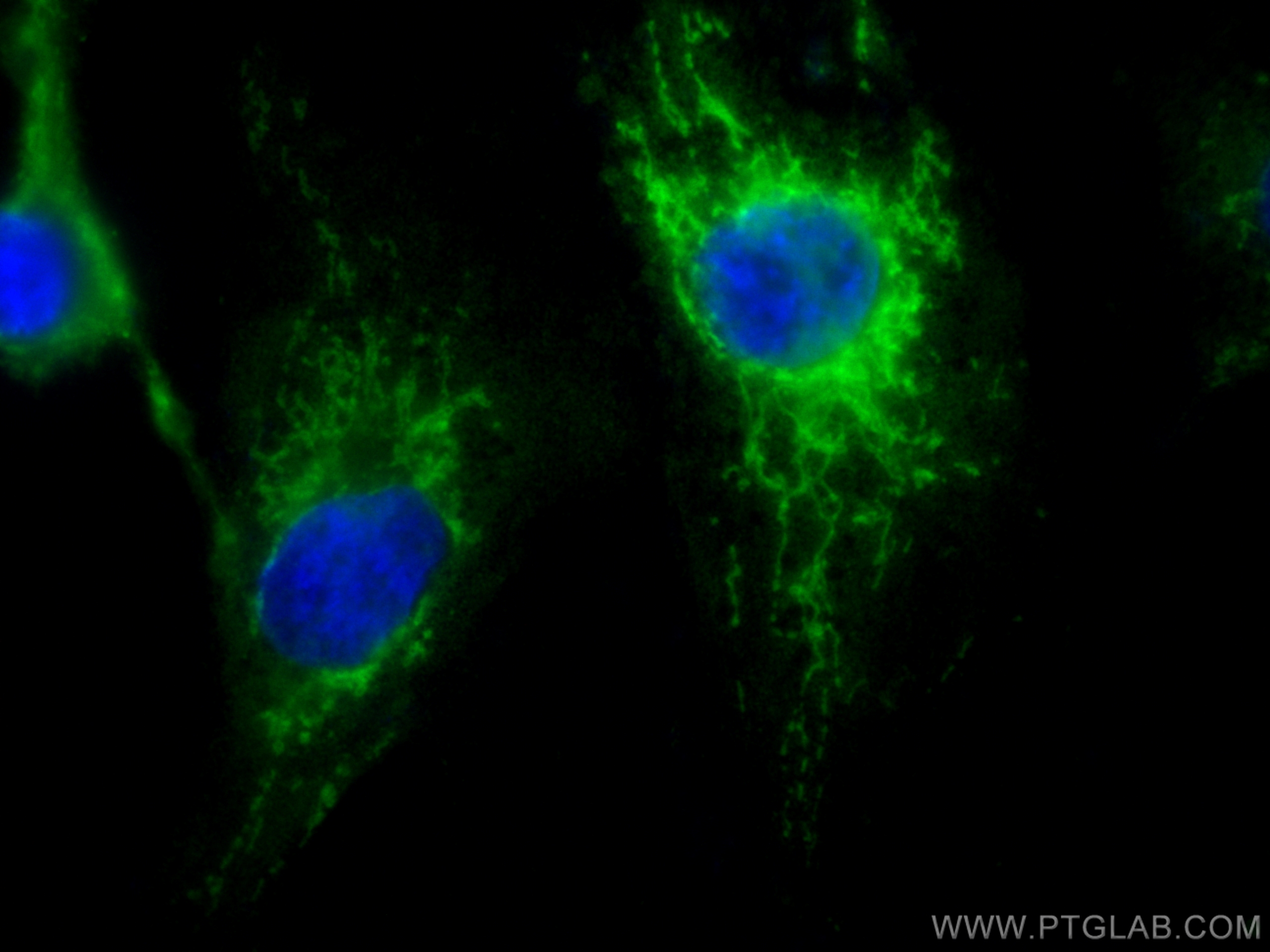 Immunofluorescence (IF) / fluorescent staining of HUVEC cells using SOD2 Recombinant antibody (83519-4-RR)