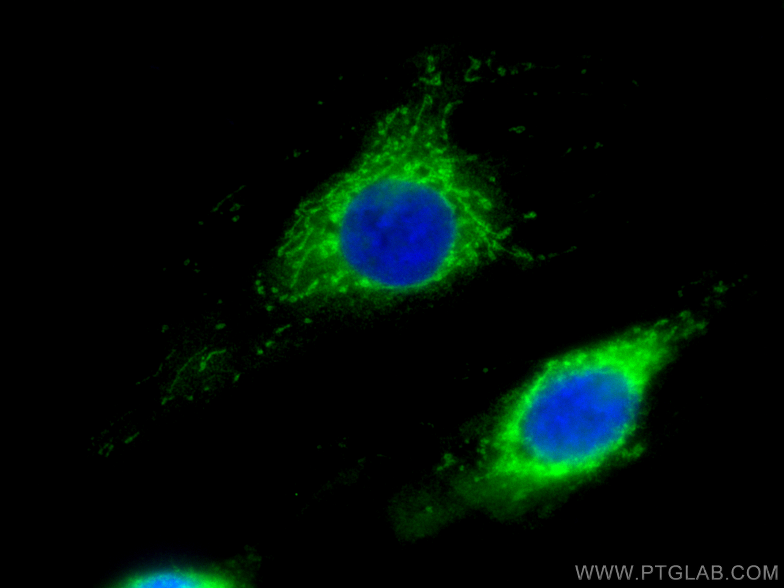 Immunofluorescence (IF) / fluorescent staining of HUVEC cells using SOD2 Recombinant antibody (83519-4-RR)