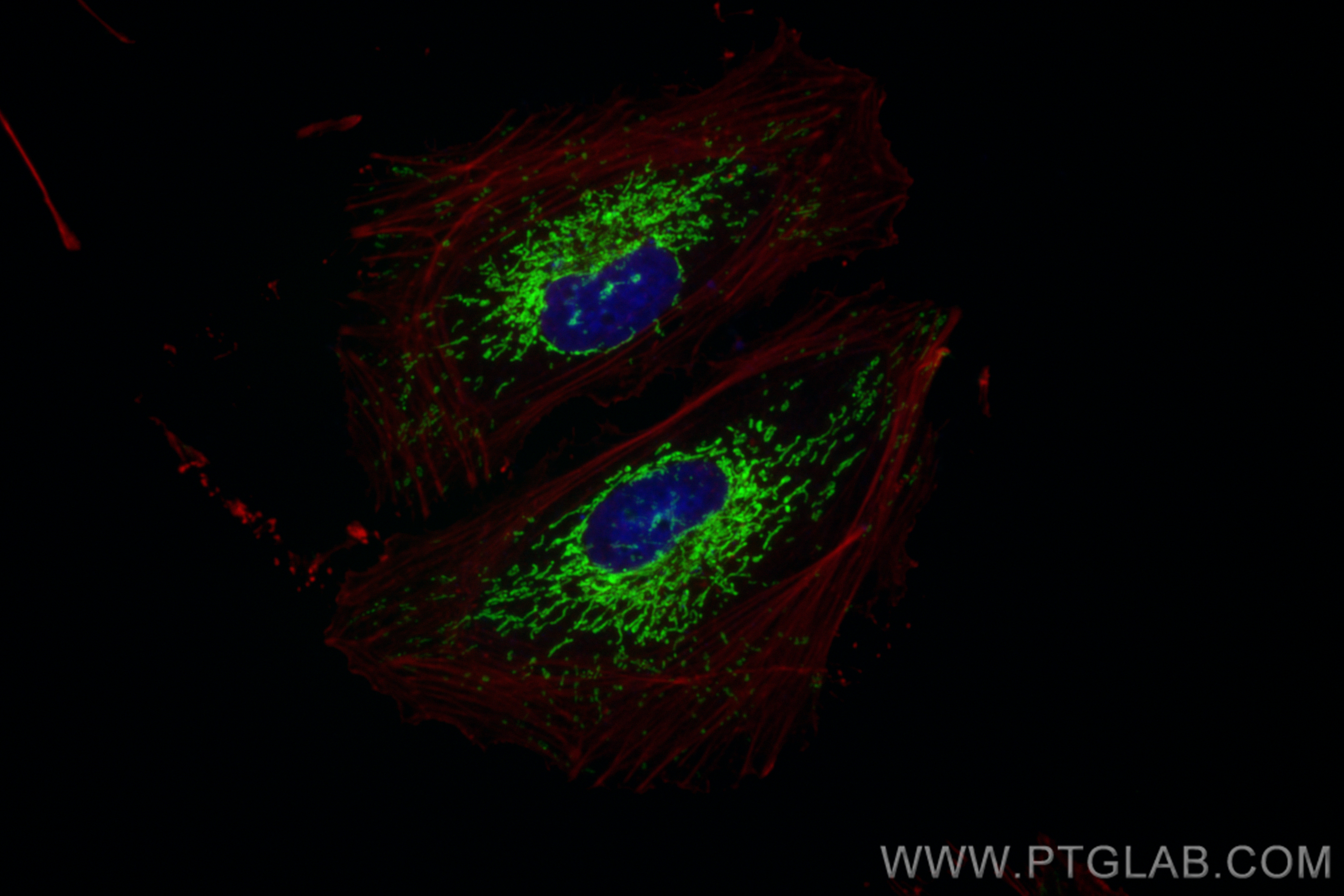 Immunofluorescence (IF) / fluorescent staining of HeLa cells using CoraLite® Plus 488-conjugated SOD2 Recombinant ant (CL488-83519-2)