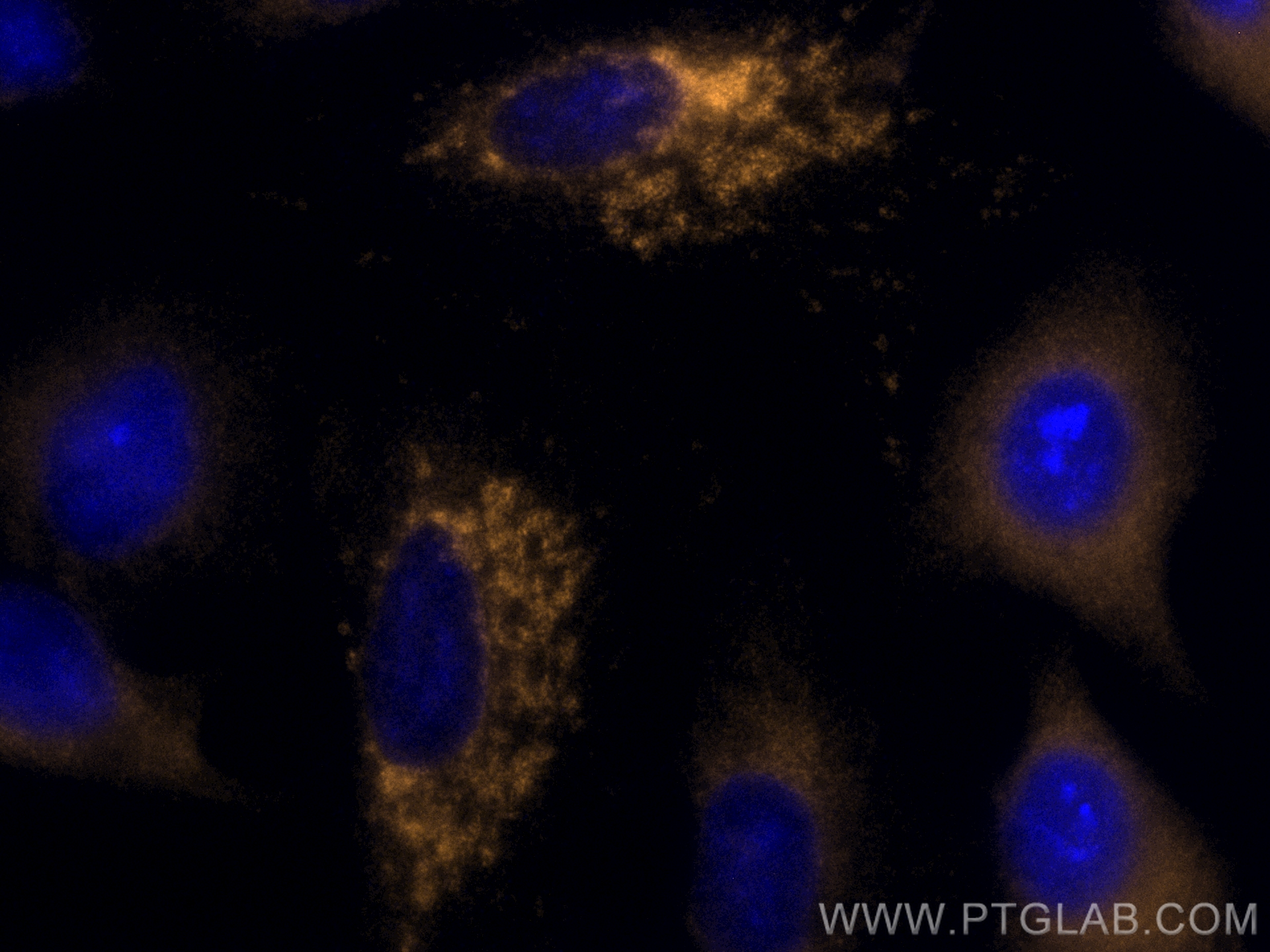 Immunofluorescence (IF) / fluorescent staining of A549 cells using CoraLite®555-conjugated SOD2 Monoclonal antibody (CL555-66474)