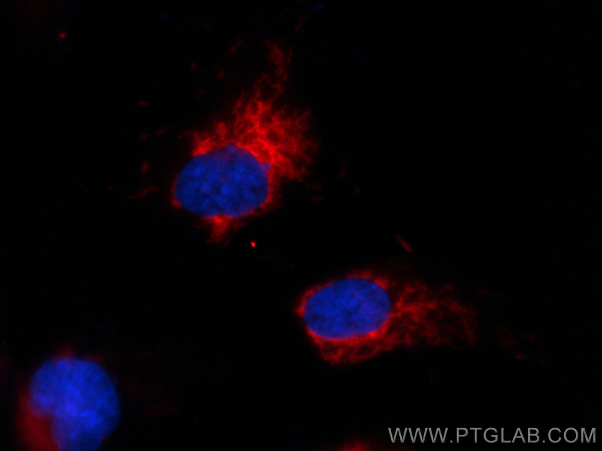 Immunofluorescence (IF) / fluorescent staining of HUVEC cells using CoraLite®594-conjugated SOD2 Recombinant antibody (CL594-83519-3)