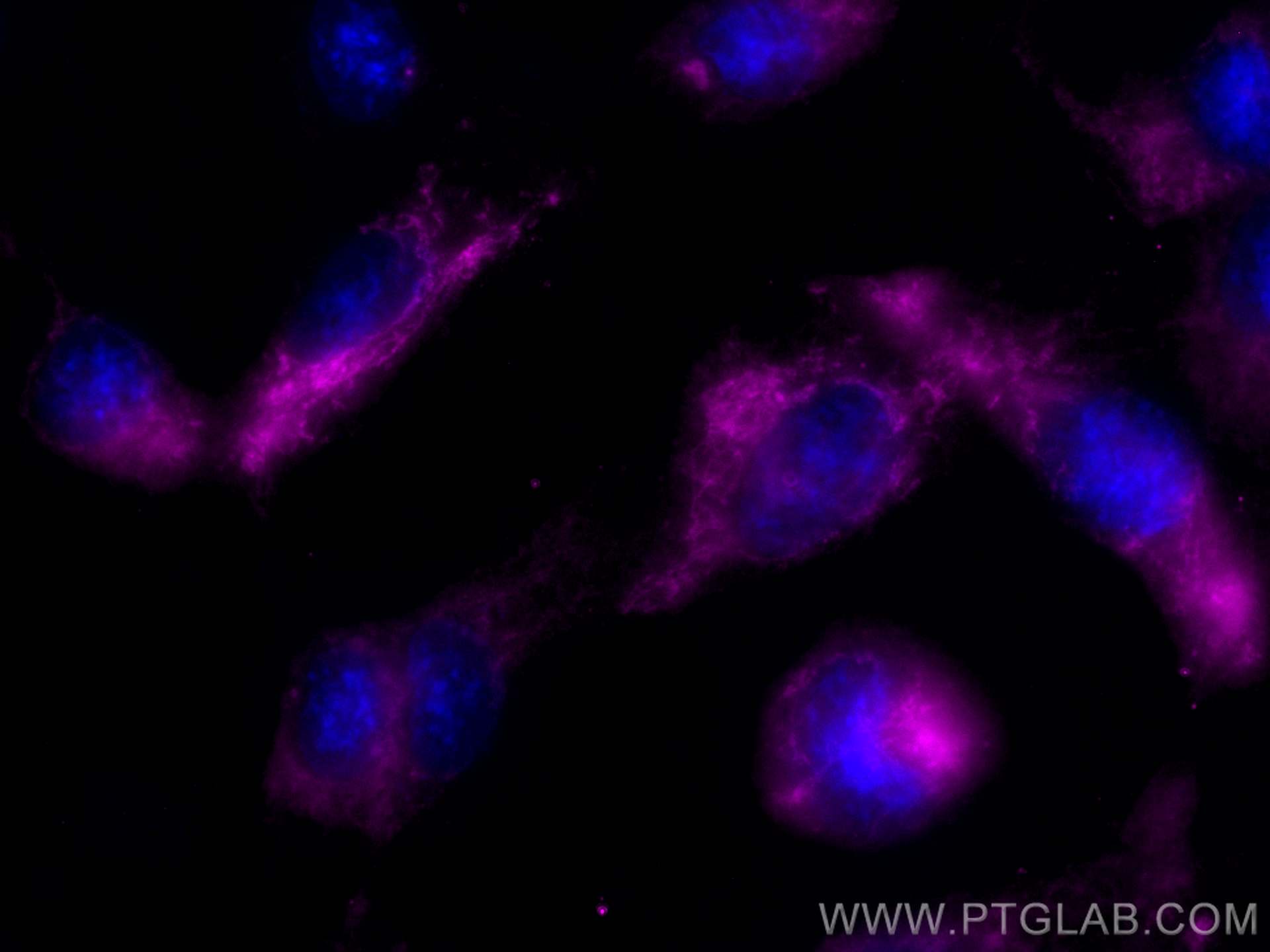 Immunofluorescence (IF) / fluorescent staining of HUVEC cells using CoraLite® Plus 647-conjugated SOD2 Monoclonal anti (CL647-66474)