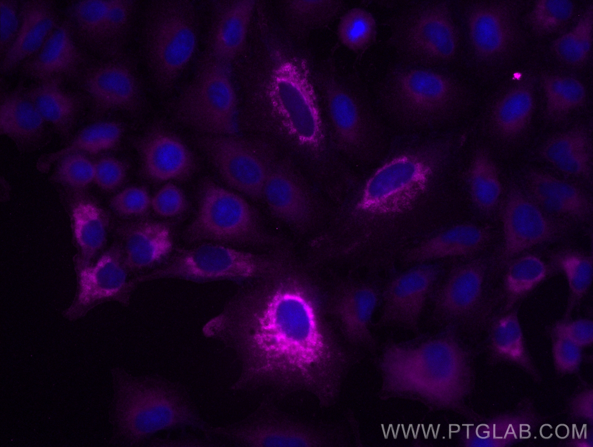 Immunofluorescence (IF) / fluorescent staining of A549 cells using CoraLite® Plus 647-conjugated SOD2 Monoclonal anti (CL647-66474)