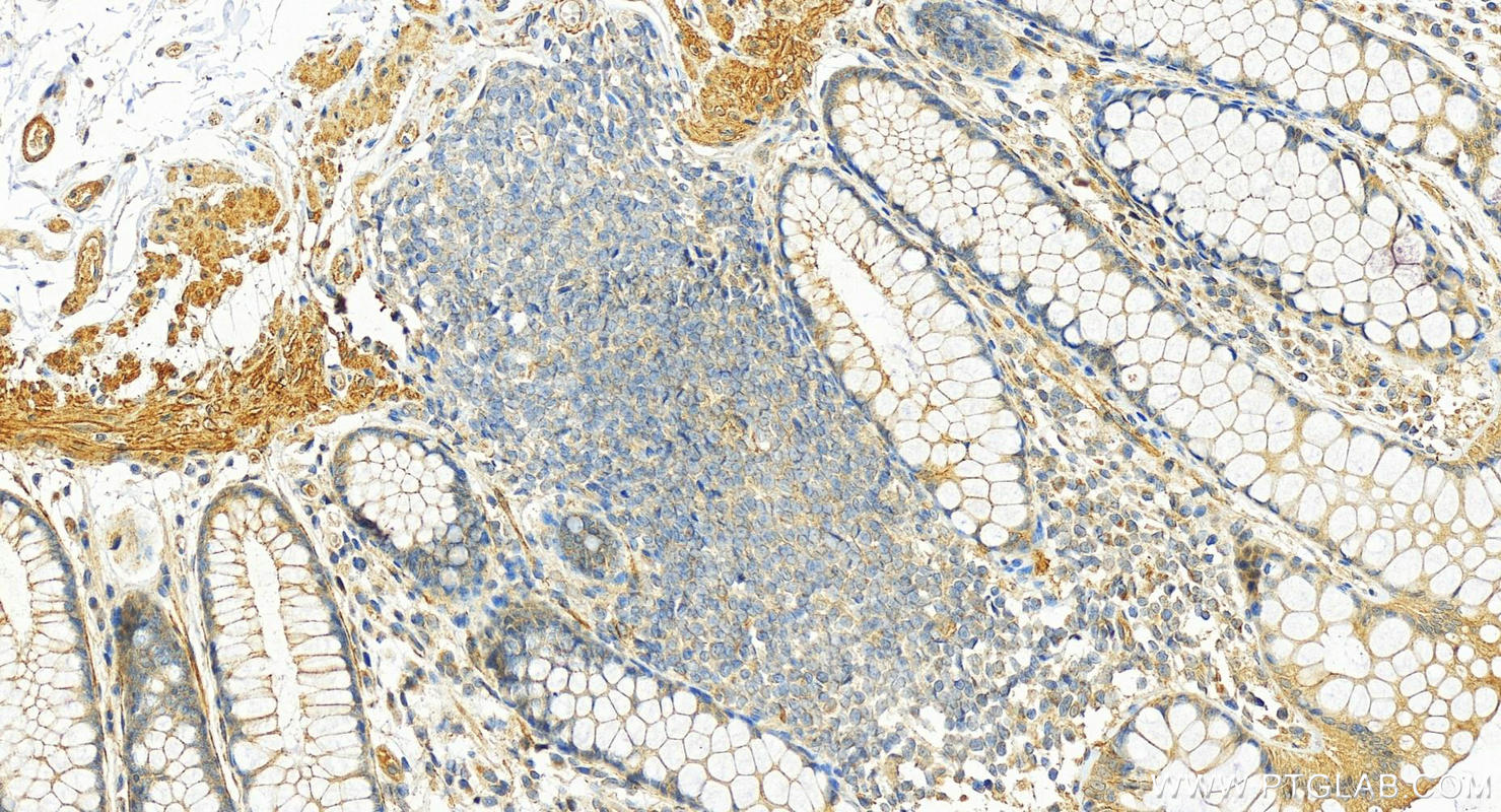 Immunohistochemistry (IHC) staining of human colon tissue using SORBS1 Polyclonal antibody (13854-1-AP)