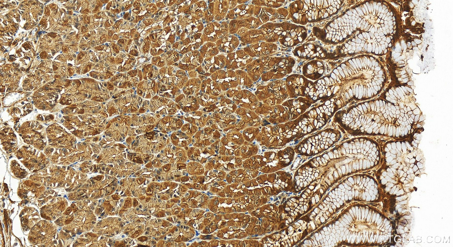 Immunohistochemistry (IHC) staining of human stomach tissue using SORBS1 Polyclonal antibody (13854-1-AP)